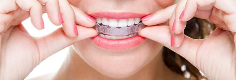 Mouth/Night Guards