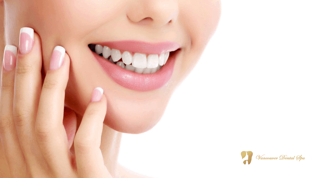Smile Makeover in Vancouver