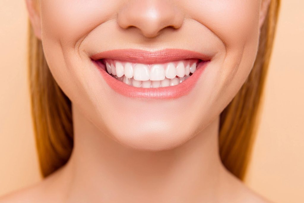 Teeth Whitening in Vancouver