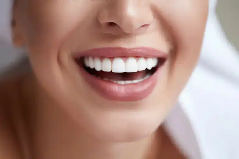 Cosmetic Dentistry in Vancouver