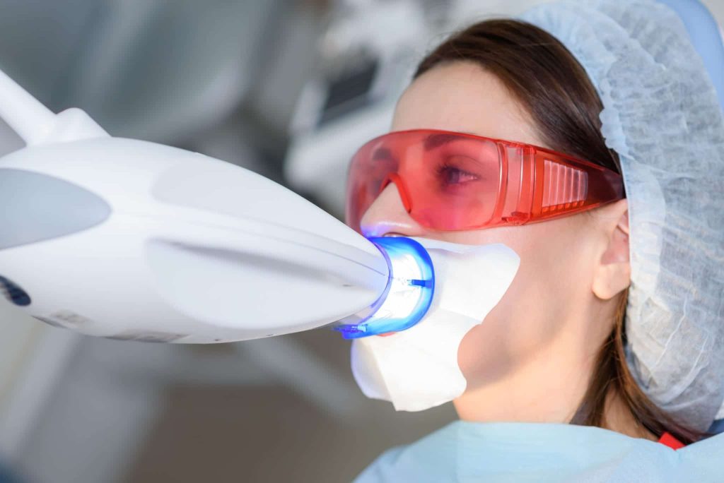 teeth whitening with zoom!