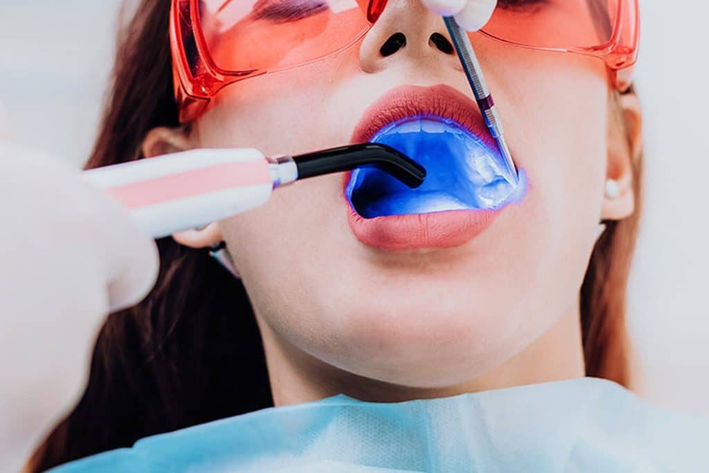laser dentistry in Vancouver